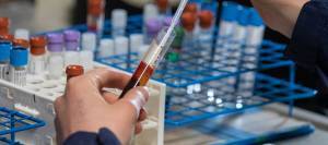 Equine nutrition research blood sample at KER Performance Center.