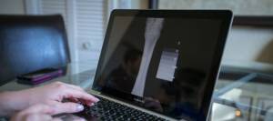 Reviewing an x-ray of a horse's cannon bone